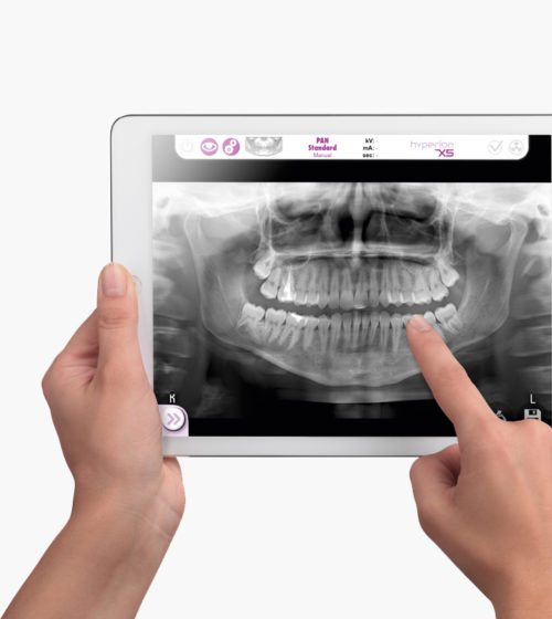 MyRay X-5 - Image 4